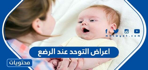 اعراض التوحد عند الرضع