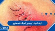 كيف اعرف ان جرح الخياطة مفتوح