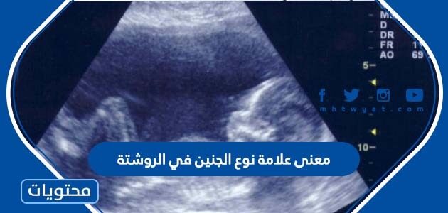 معنى علامة نوع الجنين في الروشتة