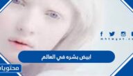 ابيض بشره في العالم