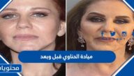 صور ميادة الحناوي قبل وبعد عملية التجميل
