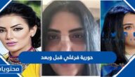 حورية فرغلي قبل وبعد عمليات التجميل