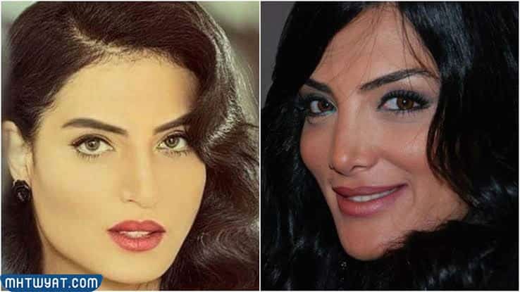 حورية فرغلي قبل وبعد عمليات التجميل