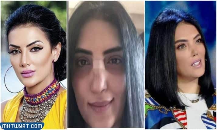 حورية فرغلي قبل وبعد عمليات التجميل