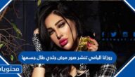 روزانا اليامي تنشر صور مرض جلدي طال جسمها