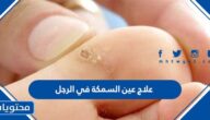 علاج عين السمكة في الرجل