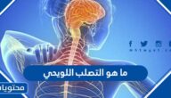 ما هو التصلب اللويحي