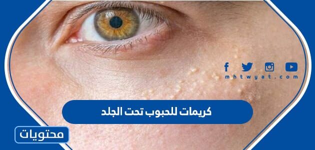 افضل كريمات للحبوب تحت الجلد