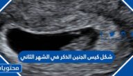 شكل كيس الجنين الذكر في الشهر الثاني