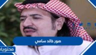 صور خالد سامي قبل وبعد المرض
