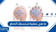 ما هي عملية استسقاء الدماغ