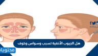 هل الجيوب الأنفية تسبب وسواس وخوف وأسباب الإصابة بها