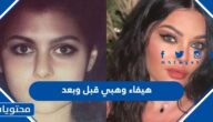 صور هيفاء وهبي قبل وبعد