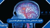 الموت الدماغي يحدث بعد انقطاع الاكسجين
