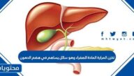 تخزن المرارة المادة الصفراء وهو سائل يساهم في هضم الدهون