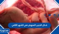 شكل الجنين المجهض في الشهر الثاني وأسباب الإجهاض وعلاماته