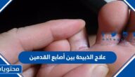علاج الذبيحة بين أصابع القدمين