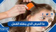 ما المرض الذي ينقله القمل