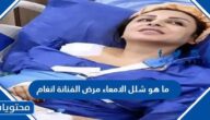 ما هو شلل الامعاء مرض الفنانة انغام