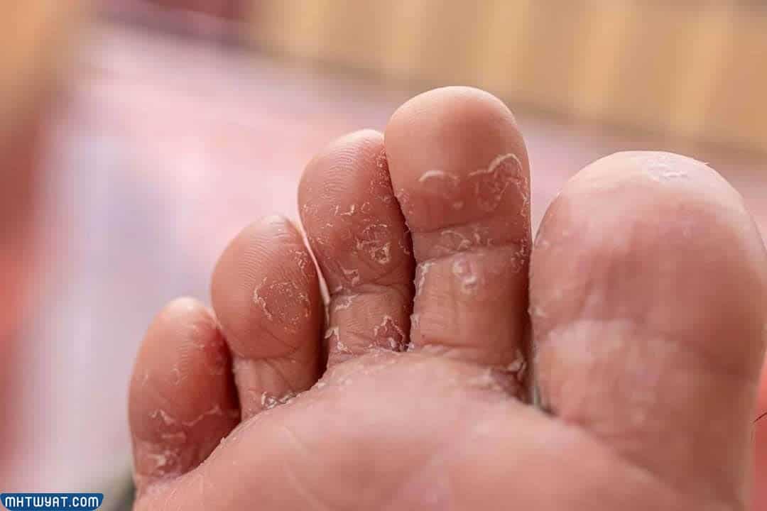 ما هي الذبيحة بين أصابع القدمين