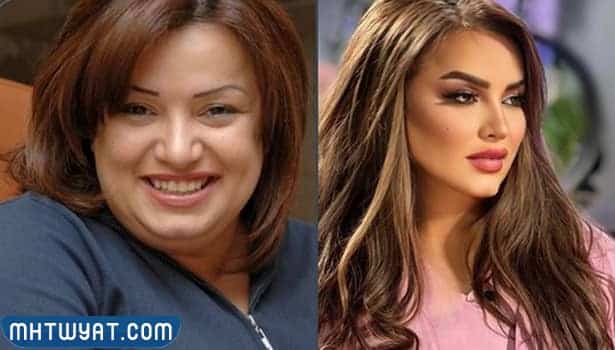 منى شداد قبل وبعد