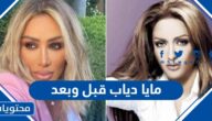 مايا دياب قبل وبعد بالصور