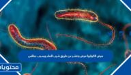 مرض الكوليرا مرض ينتشر عن طريق شرب الماء ويسبب عطاس