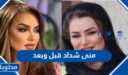 صور منى شداد قبل وبعد 2025