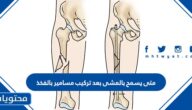 متى يسمح بالمشى بعد تركيب مسامير بالفخذ