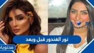 نور الغندور قبل وبعد بالصور