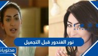 نور الغندور قبل التجميل بالصور
