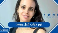 نور عمرو دياب قبل وبعد بالصور